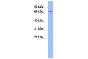 WB Suggested Anti-ZNF133 Antibody Titration:  0. (ZNF133 antibody  (Middle Region))
