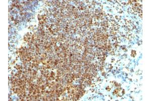 Formalin-fixed, paraffin-embedded human Tonsil stained with PCNA Monoclonal Antibody (PCNA/694) (PCNA antibody)