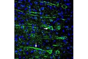 Immunohistochemistry (IHC) image for anti-SLIT and NTRK-Like Family, Member 1 (SLITRK1) (AA 383-397), (Extracellular) antibody (ABIN7043629)