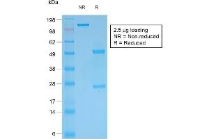 SDS-PAGE Analysis Purified Multi-Cytokeratin Mouse Recombinant Monoclonal Antibody (rKRT/457). (Recombinant Cytokeratin, Multi (Epithelial Marker) antibody)