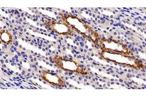 Detection of CK7 in Rat Kidney Tissue using Polyclonal Antibody to Cytokeratin 7 (CK7)