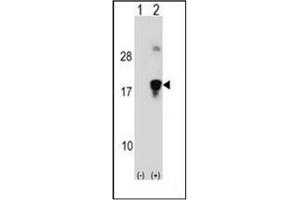 Western blot analysis of HMGN3 (arrow) using HMGN3 / TRIP7 Antibody (N-term) Cat. (HMGN3 antibody  (N-Term))