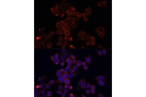 Immunofluorescence analysis of HeLa cells using MTOR antibody (ABIN6292920) at dilution of 1:100. (MTOR antibody)