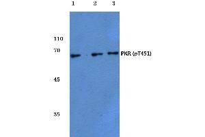 Western blot (WB) analysis of p-PKR antibody at 1/500 dilution (EIF2AK2 antibody  (pThr451))