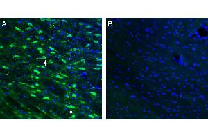 Expression of ACE2 in mouse thalamus. (Angiotensin I Converting Enzyme 2 (ACE2) Peptide)