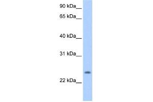 WB Suggested Anti-PQLC1 Antibody Titration:  0. (PQLC1 antibody  (Middle Region))