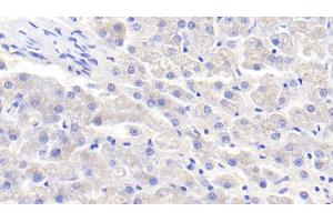 Detection of APOE in Canine Liver Tissue using Polyclonal Antibody to Apolipoprotein E (APOE) (APOE antibody  (AA 1-172))