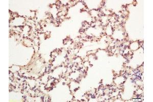 Formalin-fixed and paraffin embedded rat lung labeled with Rabbit Anti-AMBRA1 Polyclonal Antibody, Unconjugated 1:200 followed by conjugation to the secondary antibody and DAB staining (AMBRA1 antibody  (AA 221-320))