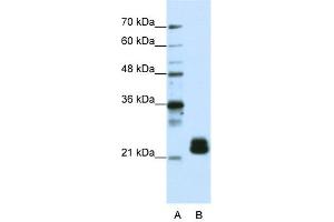 WB Suggested Anti-TMED4 Antibody Titration:  1.