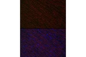 Immunofluorescence analysis of rat heart using Desminmin Rabbit pAb (ABIN3021114, ABIN3021115, ABIN3021116 and ABIN6213957) at dilution of 1:100 (40x lens). (Desmin antibody  (AA 121-470))
