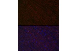 Immunofluorescence analysis of rat heart using Desminmin Rabbit pAb (ABIN3021114, ABIN3021115, ABIN3021116 and ABIN6213957) at dilution of 1:100 (40x lens). (Desmin antibody  (AA 121-470))