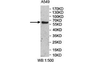 Western Blotting (WB) image for anti-UDP Glucuronosyltransferase 2 Family, Polypeptide A3 (UGT2A3) antibody (ABIN1856379)