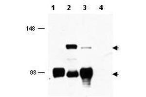 Western blot using  affinity purified anti-MECT1 antibody shows detection of endogenous MECT1 (lower arrowhead) and MECT1-MAML2 fusion protein (top arrowhead) in cell lysates. (CRTC1 antibody  (AA 19-34))