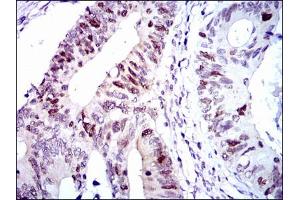 Image no. 3 for anti-Cyclin-Dependent Kinase 2 (CDK2) (AA 197-295) antibody (ABIN1497393)