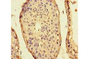 Immunohistochemistry of paraffin-embedded human testis tissue using ABIN7169848 at dilution of 1:100 (SMIM1 antibody  (AA 1-46))