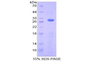 SDS-PAGE (SDS) image for Ribonuclease/angiogenin Inhibitor 1 (RNH1) (AA 218-444) protein (His tag) (ABIN2126691)