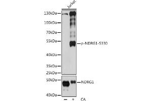 Western Blotting (WB) image for anti-N-Myc Downstream Regulated 1 (NDRG1) (pSer330) antibody (ABIN7268784)