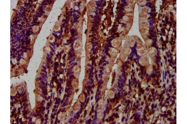 MCC antibody  (AA 479-611)