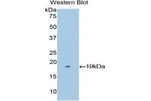 Western blot analysis of the recombinant protein. (Periostin antibody  (AA 500-630))