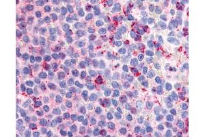 Anti-GPR132 / G2A antibody IHC of human spleen. (G Protein-Coupled Receptor 132 antibody  (Extracellular Domain))