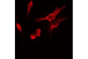 ABIN6274747 staining HeLa cells by IF/ICC. (RPS11 antibody  (C-Term))
