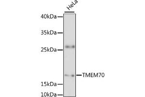 Western blot analysis of extracts of HeLa cells, using TMEM70 antibody (ABIN6133460, ABIN6149268, ABIN6149269 and ABIN6217808) at 1:3000 dilution. (Transmembrane Protein 70 (TMM70) (AA 161-260) antibody)