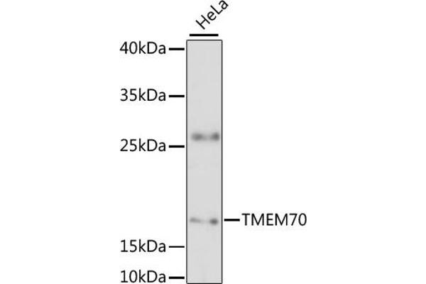 Transmembrane Protein 70 (TMM70) (AA 161-260) anticorps