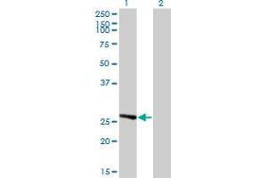 Western Blot analysis of IDI1 expression in transfected 293T cell line by IDI1 monoclonal antibody (M01), clone 6G10.
