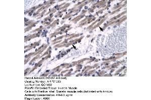 Human Muscle (ZNF391 antibody  (N-Term))
