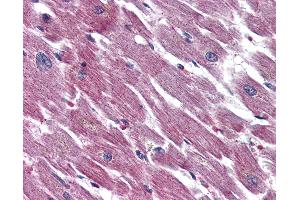 Anti-ADCYAP1R1 antibody IHC of human heart. (ADCYAP1R1 antibody  (N-Term))