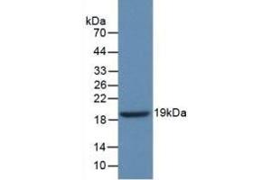 Detection of Recombinant GbA, Human using Polyclonal Antibody to Glucocerebrosidase (GBA) (GBA antibody  (AA 334-498))