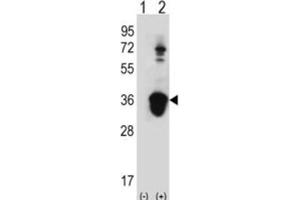Western Blotting (WB) image for anti-U2 Small Nuclear RNA Auxiliary Factor 1 (U2AF1) antibody (ABIN3001638)