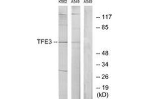 Western blot analysis of extracts from K562/A549 cells, using TFE3 Antibody. (TFE3 antibody  (AA 101-150))