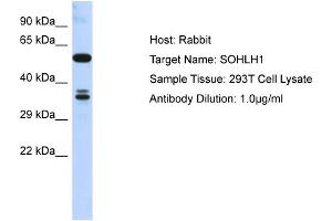 Host: Rabbit Target Name: SOHLH1 Sample Type: 293T Whole Cell lysates Antibody Dilution: 1. (SOHLH1 antibody  (C-Term))