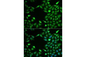 Immunofluorescence analysis of A549 cells using INTS6 antibody.