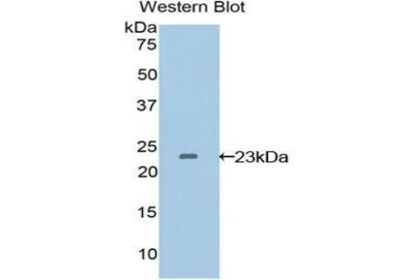 VEGFB antibody  (AA 22-207)