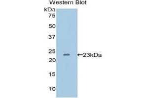 Detection of Recombinant VEGFB, Human using Polyclonal Antibody to Vascular Endothelial Growth Factor B (VEGFB) (VEGFB antibody  (AA 22-207))