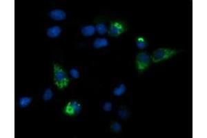 Image no. 2 for anti-Carboxypeptidase A2 (Pancreatic) (CPA2) antibody (ABIN1497597)