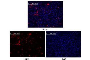 Confocal immunofluorescence analysis of methanol fixed Hela cells were transfected with pMX construct of human LIN28, cells were analyzed ~62 hours after transfection. (LIN28A antibody  (AA 93-209))