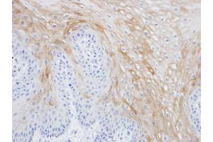 IHC-P Image Immunohistochemical analysis of paraffin-embedded Tw2. (MRGPRX4 antibody  (C-Term))