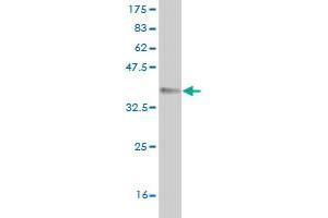 Western Blot detection against Immunogen (36. (QPCT antibody  (AA 262-359))