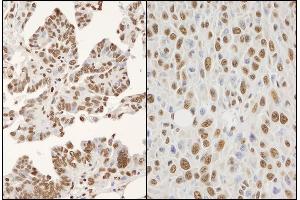 Immunohistochemistry (IHC) image for anti-Heterogeneous Nuclear Ribonucleoprotein K (HNRNPK) (AA 1-50) antibody (ABIN7454658) (HNRNPK antibody  (AA 1-50))