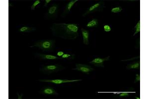 Immunofluorescence of monoclonal antibody to ITGB1BP1 on HeLa cell. (ITGB1BP1 antibody  (AA 1-200))