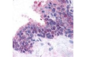 Staining of human prostate, glandular epithelium using FANCD2 polyclonal antibody . (FANCD2 antibody  (N-Term))
