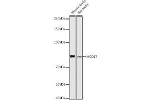 Western blot analysis of extracts of various cell lines, using MED17 antibody (ABIN6129666, ABIN6143687, ABIN6143688 and ABIN6224761) at 1:1000 dilution.
