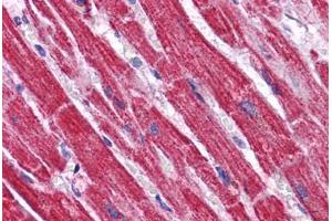 Human Heart: Formalin-Fixed, Paraffin-Embedded (FFPE) (NDUFB9 antibody  (C-Term))