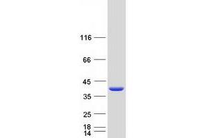 Western Blotting (WB) image for Suppressor of IKBKE 1 (SIKE1) (Transcript Variant 2) protein (Myc-DYKDDDDK Tag) (ABIN2732054)