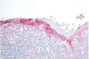 ABIN184852 (10µg/ml) staining of paraffin embedded Human Tonsil. (HSPB8 antibody  (C-Term))