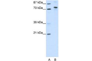 WB Suggested Anti-KIAA0737 Antibody Titration:  1.