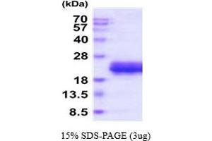 SDS-PAGE (SDS) image for Eosinophil Cationic Protein (ECP) (AA 28-160) protein (His tag) (ABIN5854791)